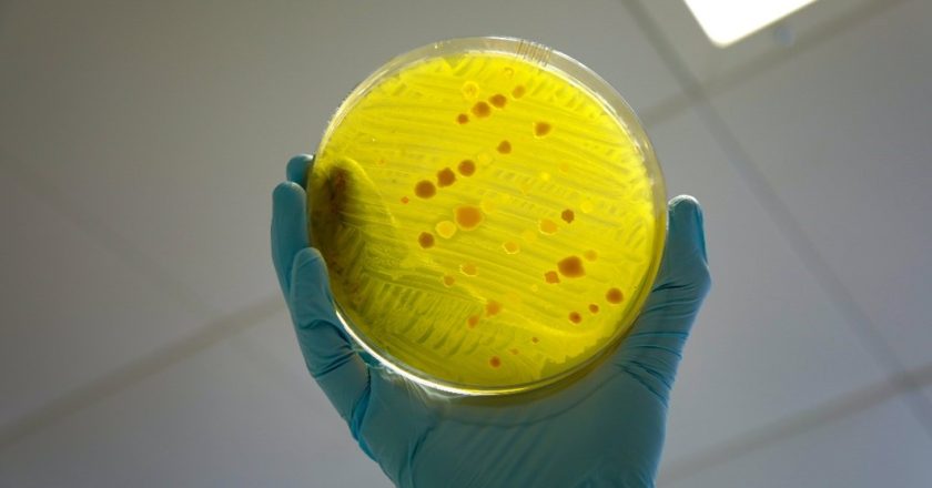 Dark Threat of Antimicrobial Resistance and Food Additives
